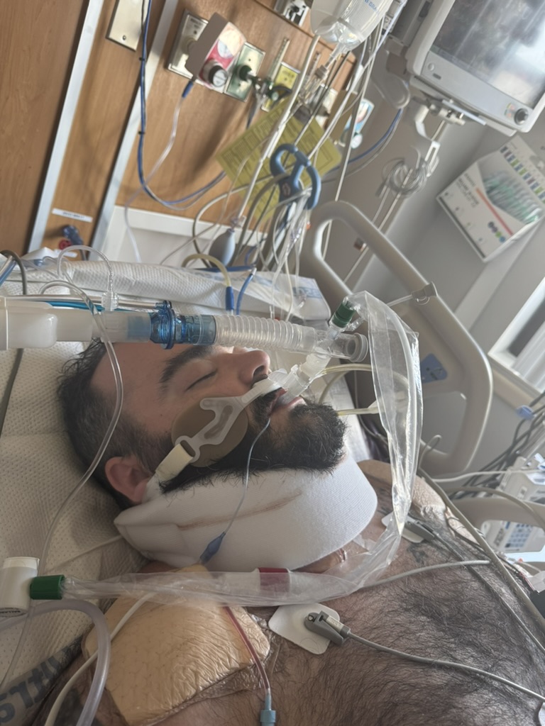 Michael lies in a hospital bed with a breathing tube, ventilator tubing, a neck support, and monitoring equipment.