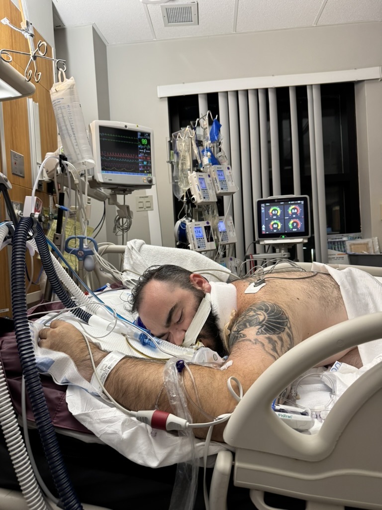Michael lies face-down in an ICU bed while connected to breathing support and monitoring equipment.